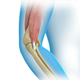 Elbow Anatomy