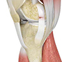 Ligament Injuries