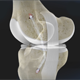 Posterior Cruciate Ligament Reconstruction