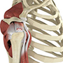 Articular Cartilage Defect