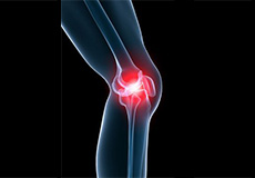 Subluxation