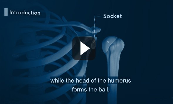 Patient Education video